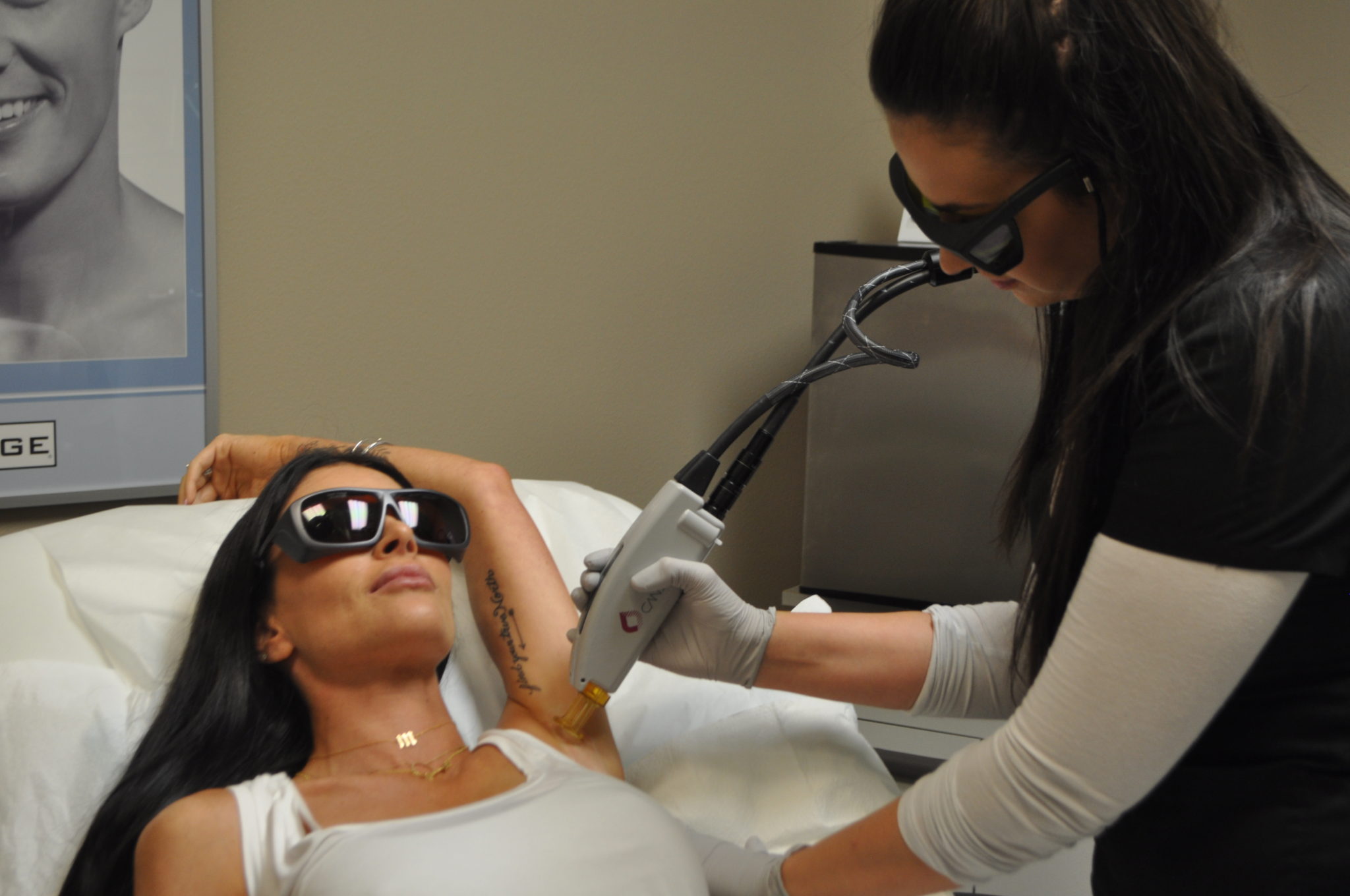 ideal image laser hair removal